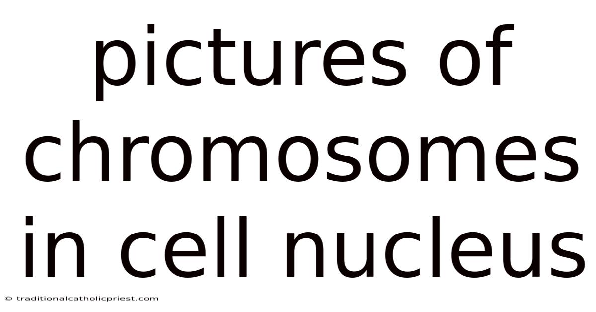 Pictures Of Chromosomes In Cell Nucleus