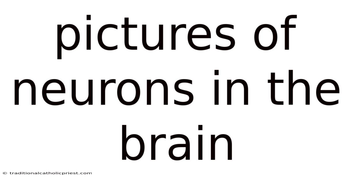 Pictures Of Neurons In The Brain