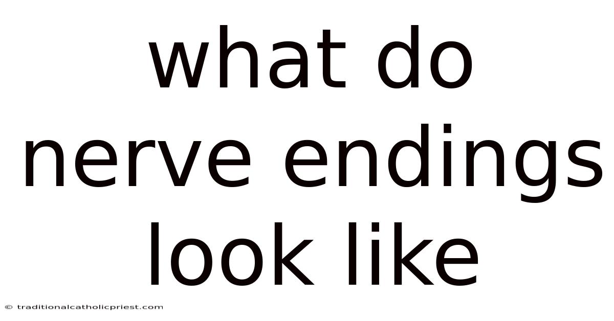 What Do Nerve Endings Look Like