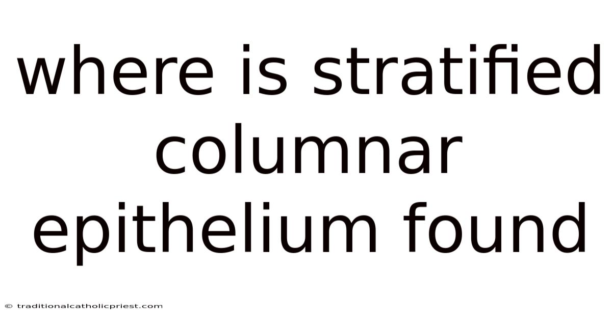 Where Is Stratified Columnar Epithelium Found